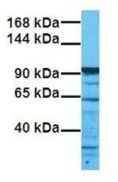 Anti-SIRT1 antibody, N-term used in Western Blot (WB). GTX30870