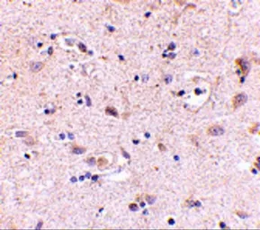 Anti-SATB2 antibody used in IHC (Paraffin sections) (IHC-P). GTX30894