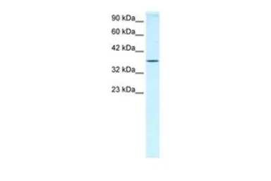 Anti-HOXA7 antibody, N-term used in Western Blot (WB). GTX30912