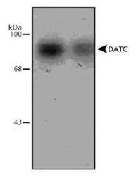 Anti-Dopamine Transporter antibody, C-Term used in Western Blot (WB). GTX30998