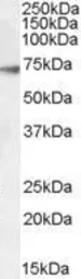 Anti-GABA A Receptor alpha 4 antibody, Internal used in Western Blot (WB). GTX31003