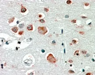 Anti-GABA A Receptor alpha 4 antibody, Internal used in IHC (Paraffin sections) (IHC-P). GTX31003