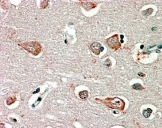 Anti-GABA A Receptor beta 3 antibody, Internal used in IHC (Paraffin sections) (IHC-P). GTX31010
