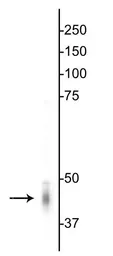 Anti-GABA A Receptor gamma 2 antibody used in Western Blot (WB). GTX31013