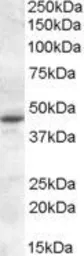 Anti-Melatonin Receptor 1A antibody, Internal used in Western Blot (WB). GTX31054