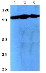 Anti-mGluR2 + mGluR3 antibody used in Western Blot (WB). GTX31056