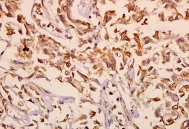 Anti-mGluR2 + mGluR3 antibody used in IHC (Paraffin sections) (IHC-P). GTX31056