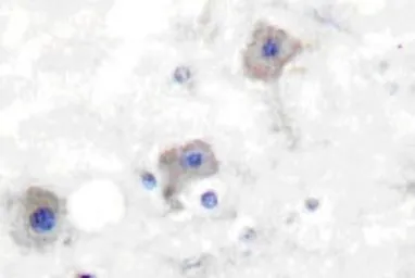 Anti-mGluR2 + mGluR3 antibody used in IHC (Paraffin sections) (IHC-P). GTX31056