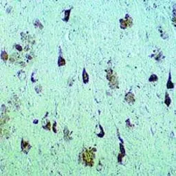 Anti-Neurofibrillary Tangles antibody used in IHC (Paraffin sections) (IHC-P). GTX31067