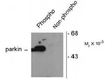 Anti-Parkin (phospho Ser101) antibody used in Western Blot (WB). GTX31094