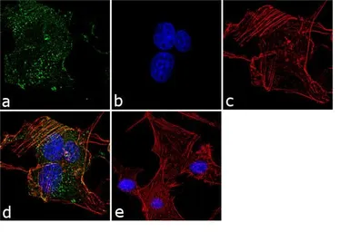 Anti-Huntingtin (neoepitope 513) antibody [3-19] used in Immunocytochemistry/ Immunofluorescence (ICC/IF). GTX31097