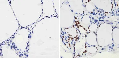Anti-PAX8 antibody [1F8-3A8] used in IHC (Paraffin sections) (IHC-P). GTX31119