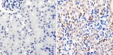 Anti-PAX8 antibody [1F8-3A8] used in IHC (Paraffin sections) (IHC-P). GTX31119