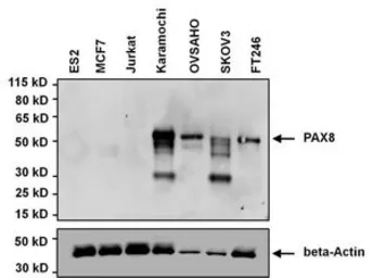 Anti-PAX8 antibody [1F8-3A8] used in Western Blot (WB). GTX31119