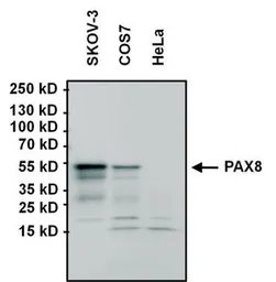 Anti-PAX8 antibody [1F8-3A8] used in Western Blot (WB). GTX31119