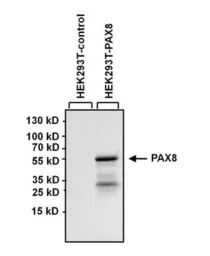 Anti-PAX8 antibody [1F8-3A8] used in Western Blot (WB). GTX31119