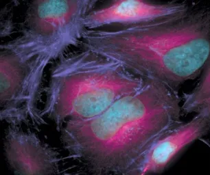 Anti-alpha Tubulin antibody [236-10501] used in Immunocytochemistry/ Immunofluorescence (ICC/IF). GTX31126