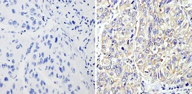 Anti-RhoA + RhoB + RhoC antibody [1A11-4G10] used in IHC (Paraffin sections) (IHC-P). GTX31128