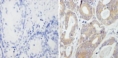 Anti-RhoA + RhoB + RhoC antibody [1A11-4G10] used in IHC (Paraffin sections) (IHC-P). GTX31128