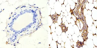 Anti-RhoA + RhoB + RhoC antibody [1A11-4G10] used in IHC (Paraffin sections) (IHC-P). GTX31128