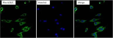 Anti-RhoA + RhoB + RhoC antibody [1A11-4G10] used in Immunocytochemistry/ Immunofluorescence (ICC/IF). GTX31128