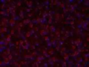 Anti-TPH2 antibody used in Immunocytochemistry/ Immunofluorescence (ICC/IF). GTX31130