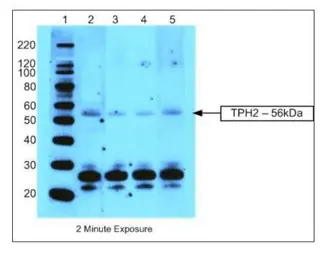 Anti-TPH2 antibody used in Western Blot (WB). GTX31130