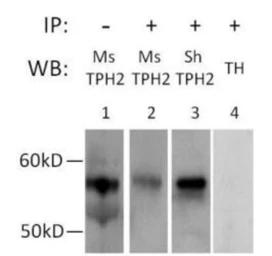 Anti-TPH2 antibody used in Immunoprecipitation (IP). GTX31130