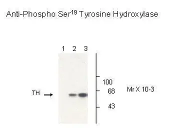 Anti-TPH2 (phospho Ser19) antibody used in Western Blot (WB). GTX31131