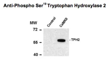 Anti-TPH2 (phospho Ser19) antibody used in Western Blot (WB). GTX31131