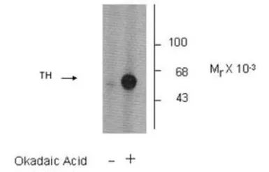 Anti-Tyrosine Hydroxylase (phospho Ser31) antibody used in Western Blot (WB). GTX31133