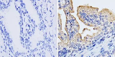 Anti-RhoA + RhoC antibody [1B3-4A10] used in IHC (Paraffin sections) (IHC-P). GTX31144