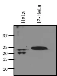 Anti-RhoA + RhoC antibody [1B3-4A10] used in Immunoprecipitation (IP). GTX31144