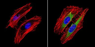 Anti-RhoA + RhoC antibody [1B3-4A10] used in Immunocytochemistry/ Immunofluorescence (ICC/IF). GTX31144