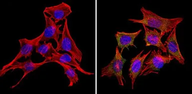 Anti-Rap1 antibody [1D2-1C64] used in Immunocytochemistry/ Immunofluorescence (ICC/IF). GTX31146