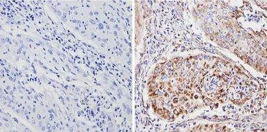 Anti-SOD2 antibody [1H6] used in IHC (Paraffin sections) (IHC-P). GTX31147