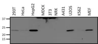 Anti-SOD2 antibody [1H6] used in Western Blot (WB). GTX31147