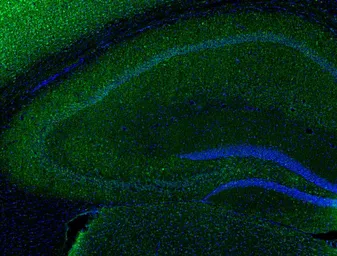 Anti-IL1 alpha antibody used in Immunohistochemistry (IHC). GTX31177