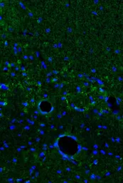 Anti-IL1 alpha antibody used in Immunohistochemistry (IHC). GTX31177