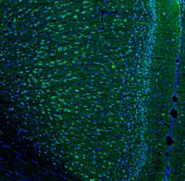 Anti-IL6 antibody used in IHC (Frozen sections) (IHC-Fr). GTX31178