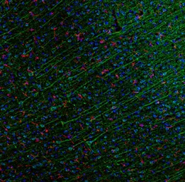 Anti-RANTES antibody used in Immunohistochemistry (IHC). GTX31209