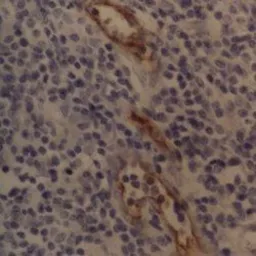 Anti-CD62P antibody [AK-6] used in IHC (Paraffin sections) (IHC-P). GTX31222