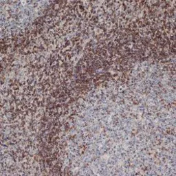 Anti-Bcl-2 antibody [100] used in IHC (Paraffin sections) (IHC-P). GTX31237
