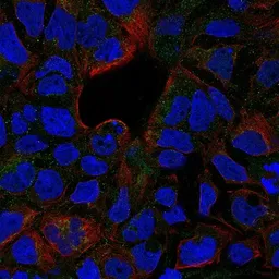 Anti-TNF Receptor II antibody used in Immunocytochemistry/ Immunofluorescence (ICC/IF). GTX31250