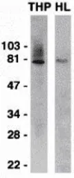 Anti-IRAK1 antibody used in Western Blot (WB). GTX31253