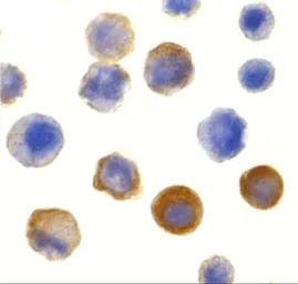 Anti-IRAK1 antibody used in Immunocytochemistry/ Immunofluorescence (ICC/IF). GTX31253