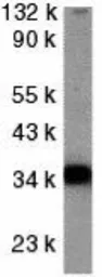 Anti-DcR2 / CD264 antibody used in Western Blot (WB). GTX31258