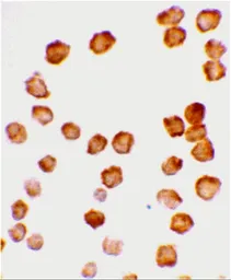 Anti-DcR2 / CD264 antibody used in Immunocytochemistry/ Immunofluorescence (ICC/IF). GTX31258