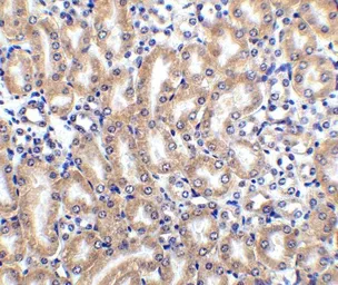 Anti-DcR2 / CD264 antibody used in IHC (Paraffin sections) (IHC-P). GTX31258