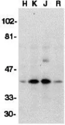 Anti-DFFB antibody used in Western Blot (WB). GTX31261